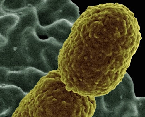 resistente klebsiella bacterie
