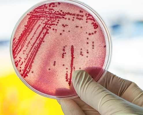 een metaal resistente bacterie in het afvalwater