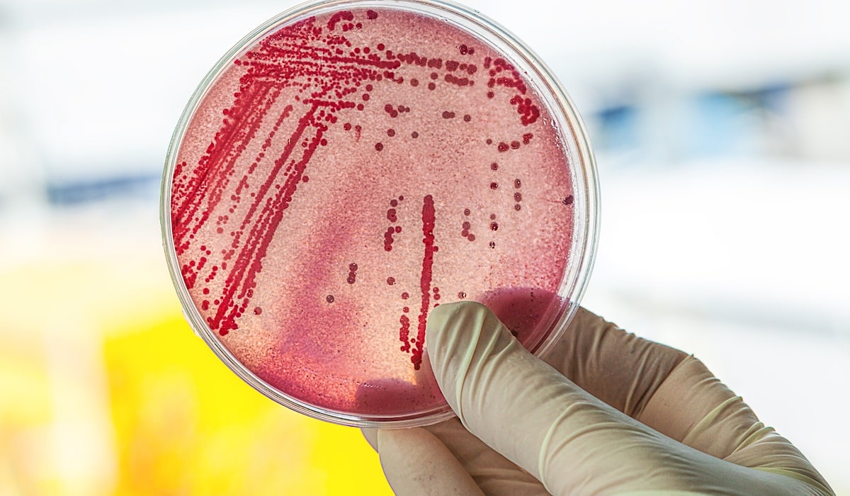 een metaal resistente bacterie in het afvalwater