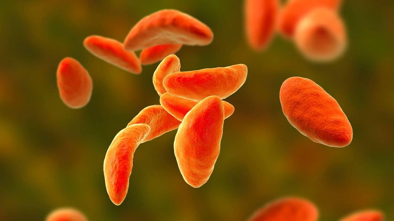 Toxoplasma gondii